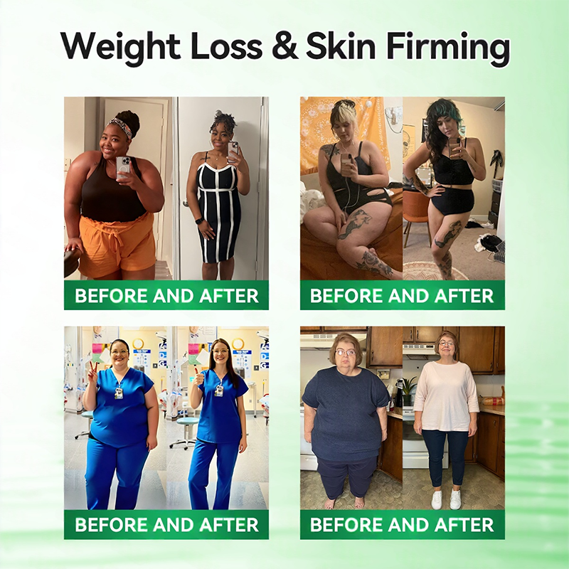 𝑶𝒇𝒇𝒊𝒄𝒊𝒂𝒍 𝑺𝒕𝒐𝒓𝒆  | 👩‍⚕️ H𝐞a𝐥r𝐢z𝐞® 1𝟐-𝐈N-1 M𝐨r𝐢n𝐠a * B𝐞r𝐛e𝐫i𝐧e * N𝐀D+ 𝐀d𝐯a𝐧c𝐞d N𝐚n𝐨 𝐌i𝐜r𝐨n𝐞e𝐝l𝐞 𝐏a𝐭c𝐡 (𝐎𝐧𝐜𝐞 𝐃𝐚𝐢𝐥𝐲, 𝐯𝐢𝐬𝐢𝐛𝐥𝐞 𝐜𝐡𝐚𝐧𝐠𝐞𝐬 𝐢𝐧 𝟕 𝐝𝐚𝐲𝐬）🔥F𝐨r 𝐎𝐛𝐞𝐬𝐢𝐭𝐲, 𝐋o𝐨s𝐞 𝐒k𝐢n, 𝐃𝐢𝐚𝐛𝐞𝐭𝐞𝐬, 𝐒𝐥𝐞𝐞𝐩 𝐀𝐩𝐧𝐞𝐚, 𝐀𝐧𝐝 𝐉𝐨𝐢𝐧𝐭 𝐈𝐬𝐬𝐮𝐞𝐬🥰🍈